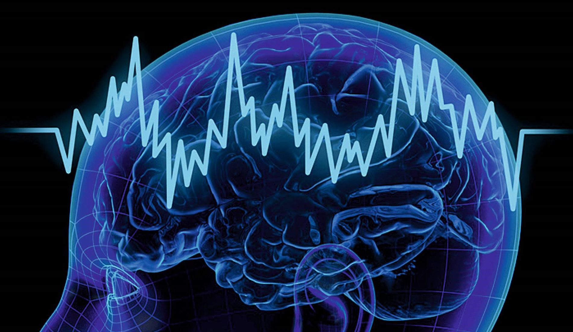 Electrophysiology