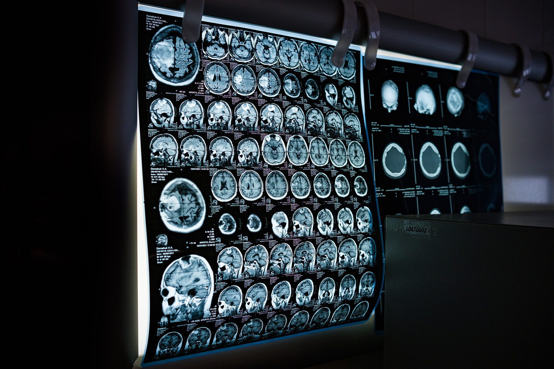 x-ray-g2b859ded7_1920
