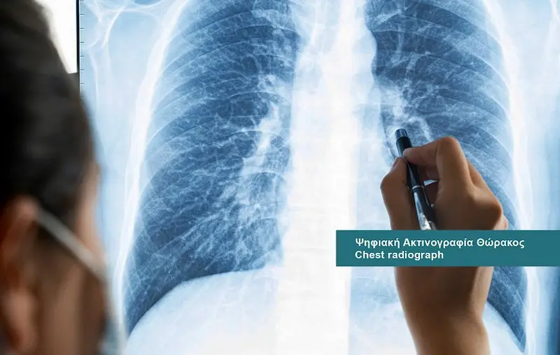 Pulmonology and Tuberculosis services at DIKTEON Medical Diagnostic Center in Strovolos - Nicosia - Cyprus