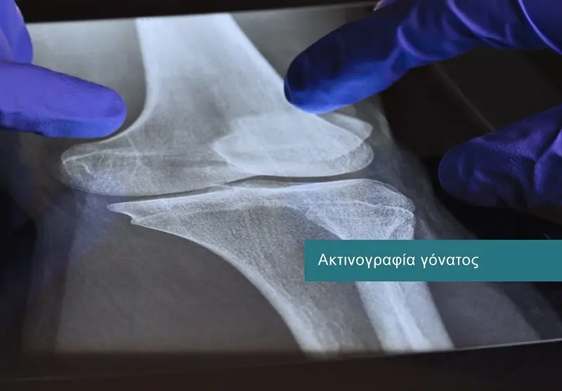 Digital X-Rays services at DIKTEON Medical Diagnostic Center in Strovolos - Nicosia - Cyprus