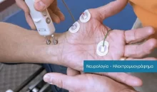 Electrophysiology [Electromyograph (EMG) - Electroencephalogram (EEG)] examinations at DIKTEON Medical Diagnostic Center in Strovolos - Nicosia - Cyprus