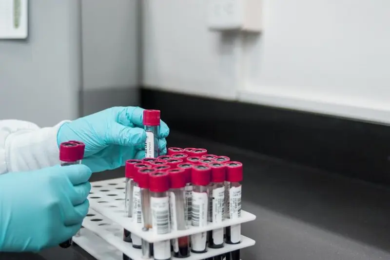 Blood Samples Blood Test Check-Up Samples