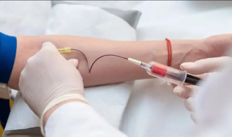 Blood Sampling Blood Sampling