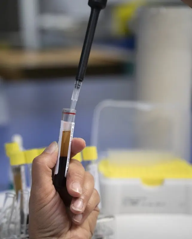 Blood sample Blood sample