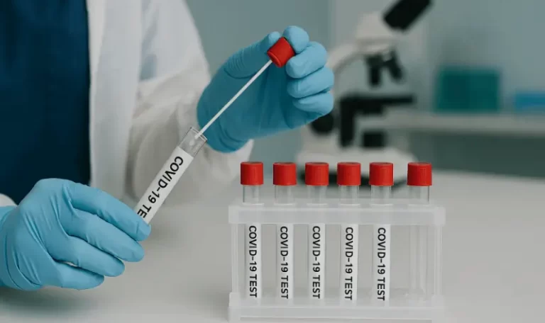 Covid-19 Covid-19 PCR and Rapid Testing at DIKTEON Medical & Diagnostic Center in Strovolos - Nicosia