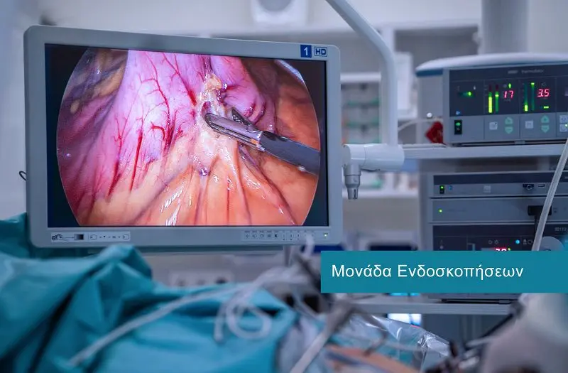 Gastrointestinal (GI) Endoscopy at DIKTEON Medical Diagnostic Center in Strovolos - Nicosia - Cyprus.