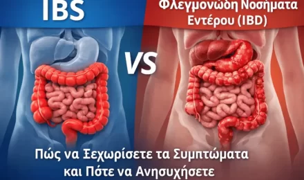 IBS vs Φλεγμονώδη Νοσήματα Εντέρου (IBD): Πώς να Ξεχωρίσετε τα Συμπτώματα και Πότε να Ανησυχήσετε