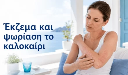 Έκζεμα και ψωρίαση το καλοκαίρι