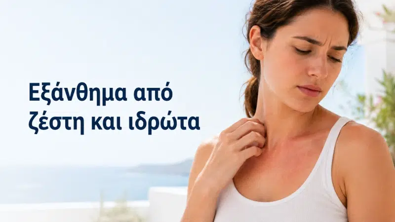 Εξάνθημα από ζέστη και ιδρώτα