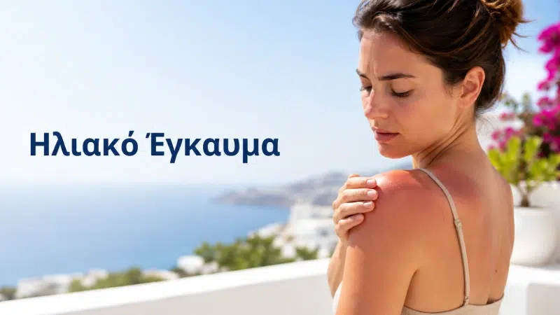 Ηλιακό Έγκαυμα