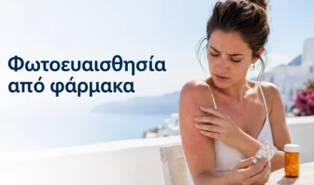Φωτοευαισθησία από φάρμακα
