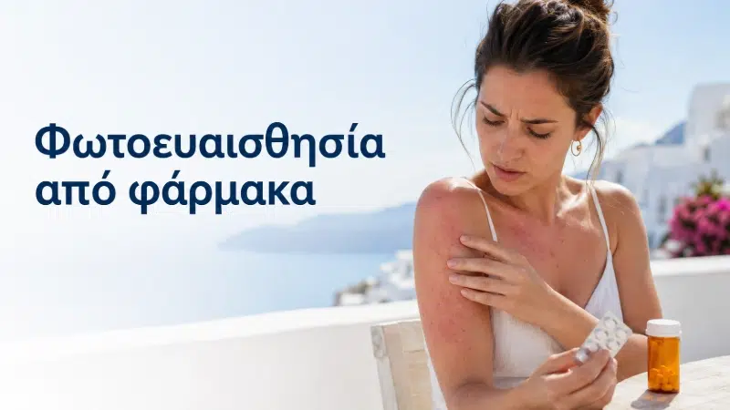 Φωτοευαισθησία από φάρμακα
